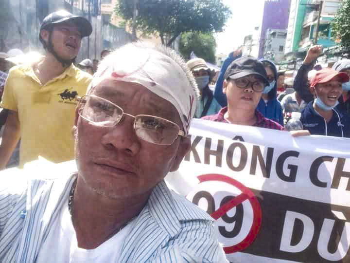 Suffering from near total blindness, Vietnamese activist granted early prison release