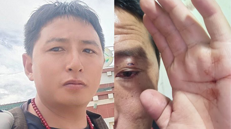 Police beat and detain Tibetan language advocate